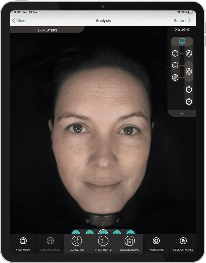 Análisis facial con OBSERV 520x en luz natural