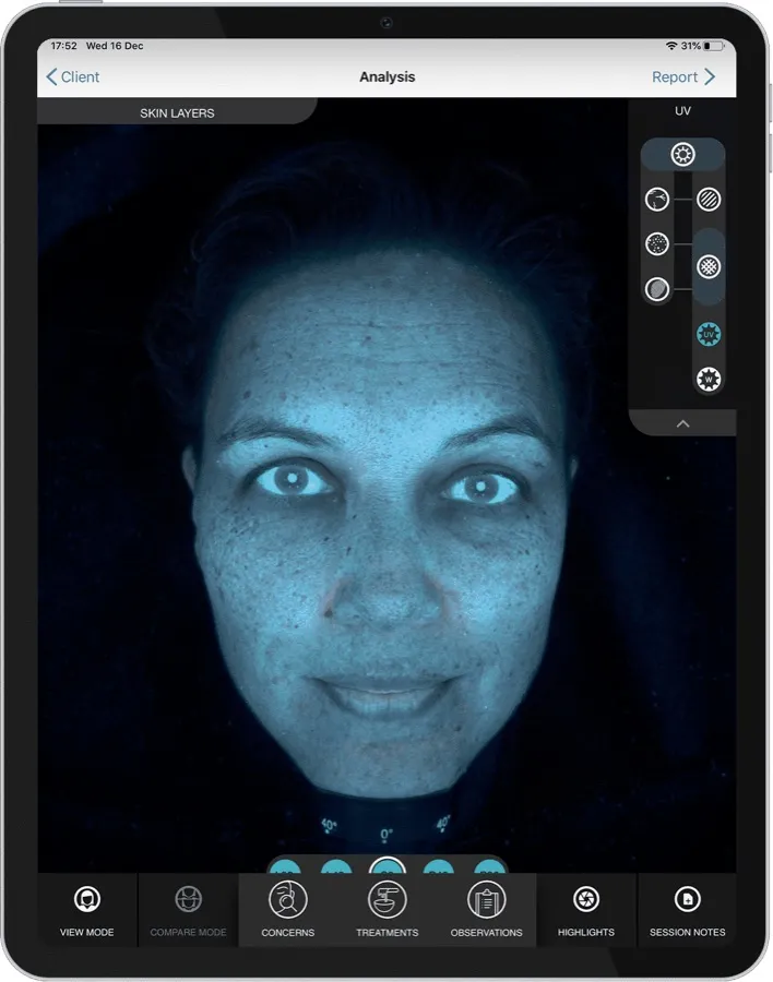 Análisis con OBSERV 520x en luz UV: revela daño no visible a simple vista