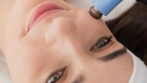Exilis Facial